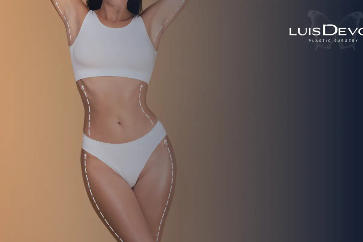Guía Completa sobre Lipoescultura: Todo lo que Debes Saber Antes de Decidir