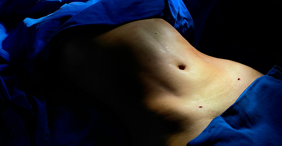 abdomen