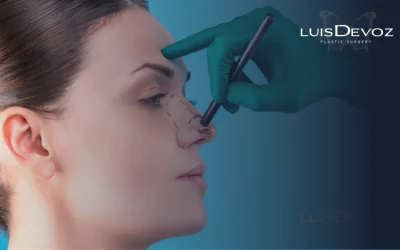 ¿Soy candidato para rinoplastia?