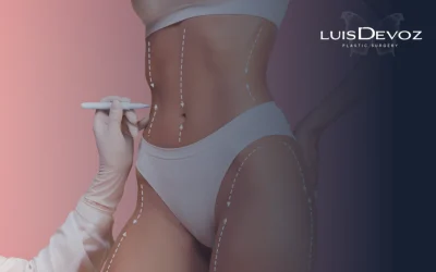 Riesgos de la Lipoescultura: Una Guía Honesta sobre Seguridad Quirúrgica