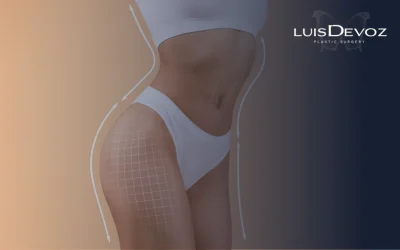 ¿Soy Candidato para una Lipoescultura? La Checklist Definitiva para Saber si Estás Listo