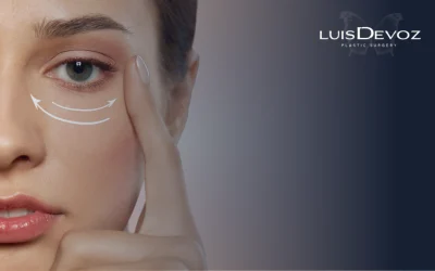 Riesgos de la Blefaroplastia: La Verdad sobre la Seguridad y Complicaciones